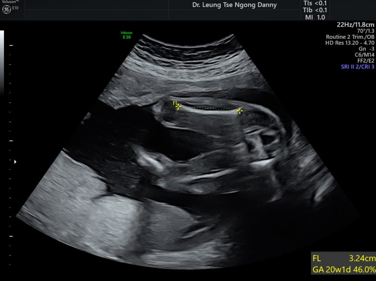 Fetal Biometry - HKOG-INFO