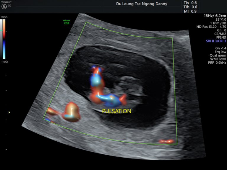 Developmental Milestones Hkog Info 7831